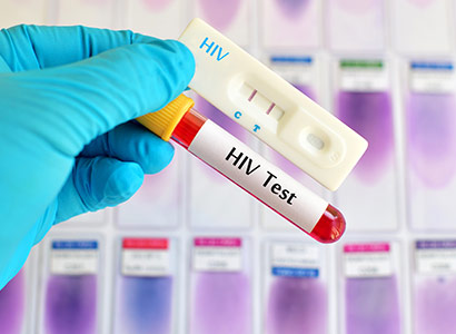 Move to address HIV among transgender people welcomed